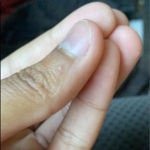 Meet your Posher, Titus